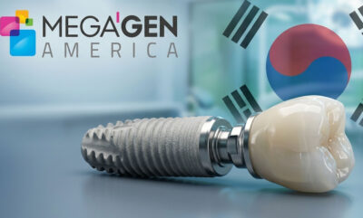 ایمپلنت مگاژن (MegaGen) | قیمت 1405، مزایا، معایب و مقایسه کامل